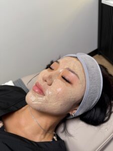 facial654