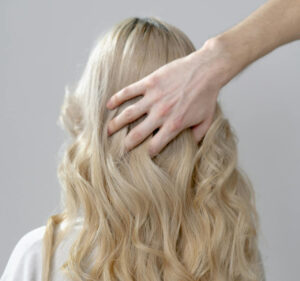 prp hair restoration