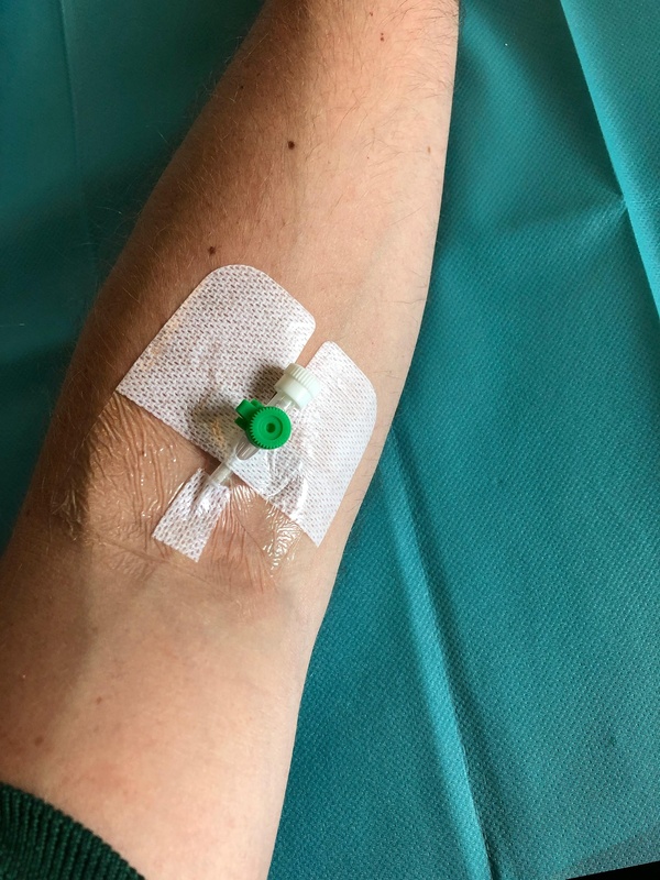 Ultrasound-guided PICC line placement